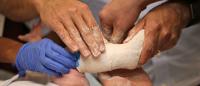 Lower extremity physical examination of a pediatric orthopedic patient.